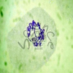 침샘염색체 슬라이드표본 침샘염샘체,슬라이드표본